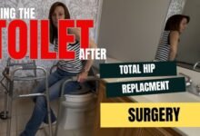 when can you use a regular toilet after hip replacement